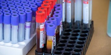 La jornada de donación de sangre ayudará a salvar vidas.