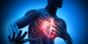 Un coctel de calor y contaminación es letal para el corazón. / Foto: Gulati R, Behfar A, Narula J y Mayo Clin Proc.