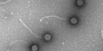 Micrografías de fagos, virus de bacterias, obtenidas en el laboratorio de Virología Ambiental y Biomédica del Instituto de Biología Integrativa de Sistemas (UV-CSIC). / Foto: EFE, Imagen facilitada por la investigadora Pilar Domingo-Calap.