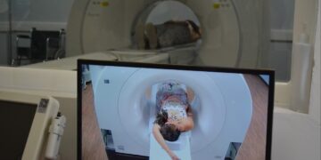 Las tomografías son necesarias para determinar algún tipo de tumor. / Foto: MSPAS.
