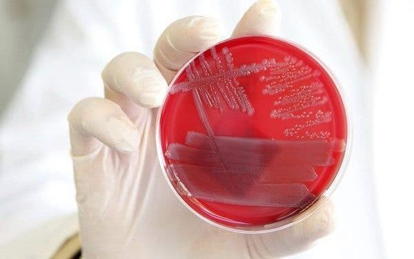 Descubren que abuso de antibióticos no es el único causante de resistencia a estos