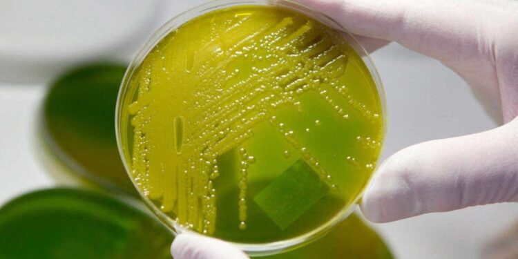 El estudio se enfocó en una bacteria multirresistente. / Foto: EFE.