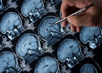 El cerebro se adapta a lo "inusual". / Foto: EFE.