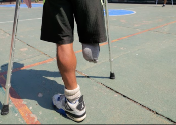 Juan Carlos Morales: “Es duro ver tus dos tenis y solo poder ponerte uno”