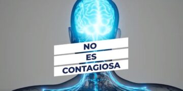 Enfermedad neurológica aguda no se trasmite de persona en persona