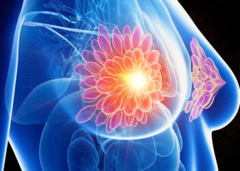 Investigan nueva terapia contra el cáncer de mama. / Foto: Bagó.