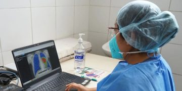 Avanzan las acciones para eliminar la tuberculosis. /Foto: OMS