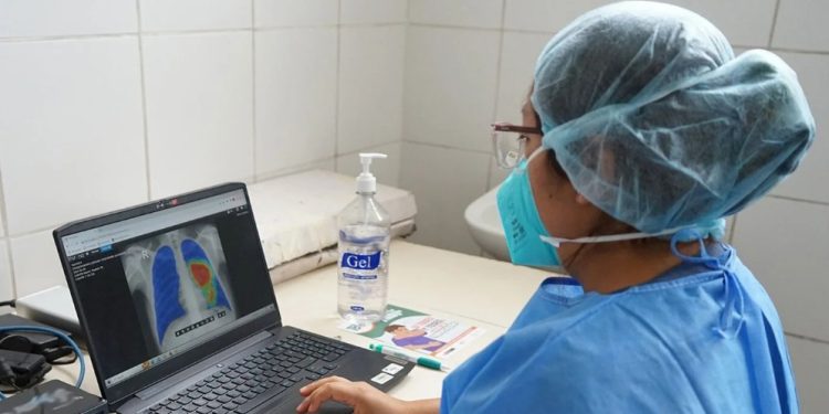 Avanzan las acciones para eliminar la tuberculosis. /Foto: OMS