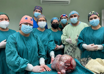 Médicos con el tumor gigante ovárico extraído. / Foto: MSPAS.