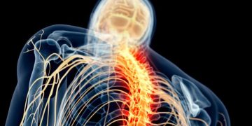 Desarrollan dispositivo para estimular la médula espinal. / Foto: Uniteco Profesional.