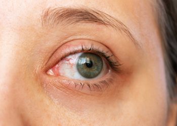 Técnica ayuda a recobrar visión en casos de ceguera hereditaria. / Foto: EFE Salud.