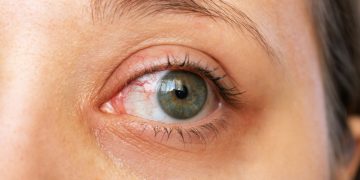 Técnica ayuda a recobrar visión en casos de ceguera hereditaria. / Foto: EFE Salud.