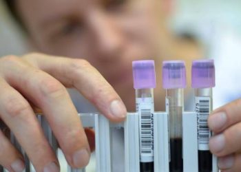 Con un análisis de sangre se puede predecir con anticipación de siete años si una persona desarrollará párkinson.