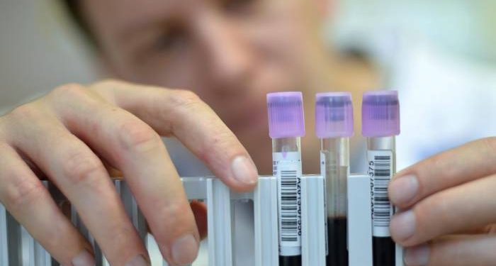 Con un análisis de sangre se puede predecir con anticipación de siete años si una persona desarrollará párkinson.