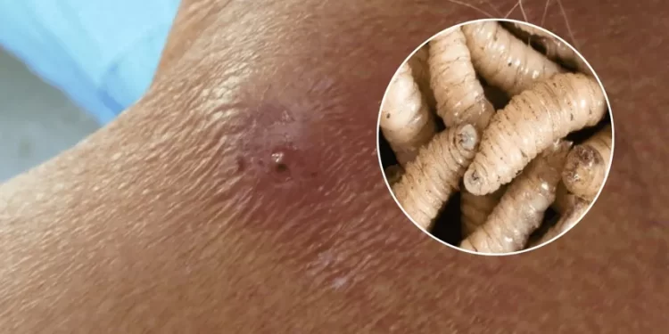 Gusano barrenador también afecta a los humanos. / Foto: Telemetro.