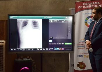 Equipo de rayos X contribuirá al diagnóstico de tuberculosis. /Foto: MSPAS.