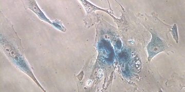 Científicos definen biomarcadores de célula ligada al envejecimiento.