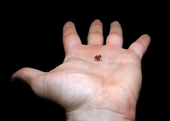 El "sapo pulga" hallado mide menos de un centímetro. / Foto: EFE/Lucas Machado Botelho/Projeto Dacnis.