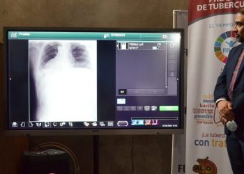 La OMS destaca la importancia de haber recuperado la capacidad de diagnóstico de la tuberculosis.
