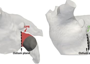 Gemelos digitales digitales del corazón para simular cirugías y establecer escenarios en pacientes con arritmias.