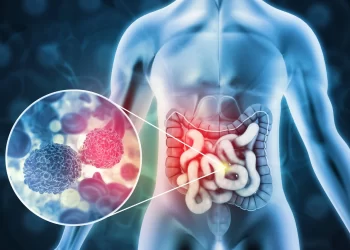 Estudio revela aumento de cáncer colorrectal en personas jóvenes. / Imagen: Rocky Mountain Cancer Centers.