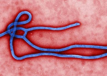 Virus del ébola ingresa por la piel humana. / Foto: microBIOblog.