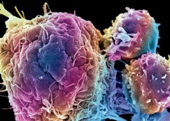 Tumores podrían ser tratados con bacterias modificadas. / Foto: La Vanguardia.