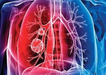 Cada 24 de marzo se celebra el día Mundial de la Tuberculosis. (Foto: archivo)