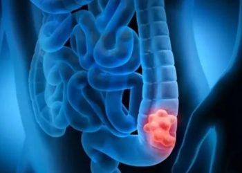 Demuestran que la inmunoterapia es eficaz contra el cáncer colorrectal es uno de los más mortales.