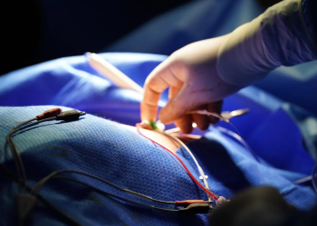 Hospital Nacional Pedro de Betancourt realizó por primera vez el implante de marcapasos definitivo. (Foto: MSPAS)