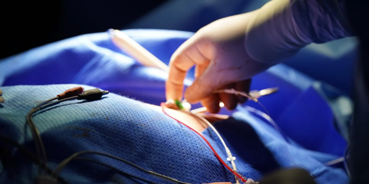 Hospital Nacional Pedro de Betancourt realizó por primera vez el implante de marcapasos definitivo. (Foto: MSPAS)