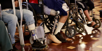 SOSEP entregó mas de 150 prótesis, órtesis y aparatos auditivos./Foto: Noé Medina.