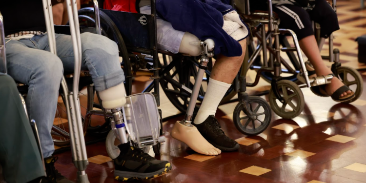 SOSEP entregó mas de 150 prótesis, órtesis y aparatos auditivos./Foto: Noé Medina.