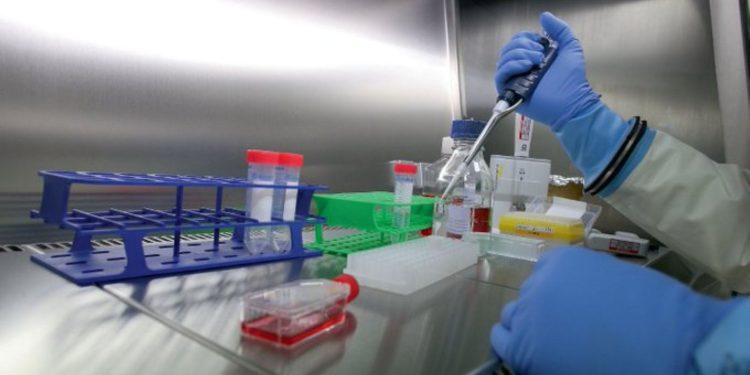 Con una sencilla prueba de sangre mediante punción digital podría detectarse el alzhéimer.