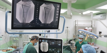 Nuevo equipo aliado dentro del quirófano fortalece la atención en el Hospital de Totonicapán. (Foto: MSPAS)