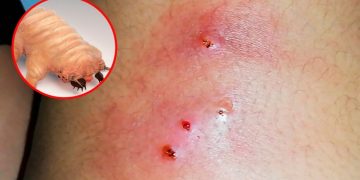 La mosca deposita sus huevesillos en heridas de animales o humanos y estos se convierten en larvas que se alimentan de tejido vivo.