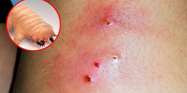 La mosca deposita sus huevesillos en heridas de animales o humanos y estos se convierten en larvas que se alimentan de tejido vivo.