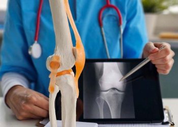 El uso de fármaco contra la gota abre nueva puerta para tratamiento de la osteoporosis.