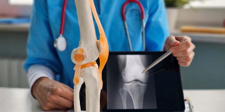 El uso de fármaco contra la gota abre nueva puerta para tratamiento de la osteoporosis.