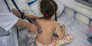 Ministro de Salud insta a retomar hábitos de vacunación ante brote de sarampión. (Foto: archivo)