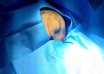Hospital de San Benito realiza cirugía de tumor a nivel óseo./Foto: MSPAS.