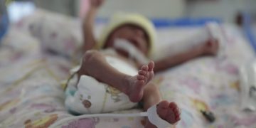 Hospital General San Juan de Dios reforzó la atención en neonatología. (Foto: archivo)