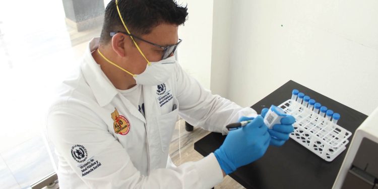 GeneXpert fortalece diagnóstico de tuberculosis en Totonicapán
